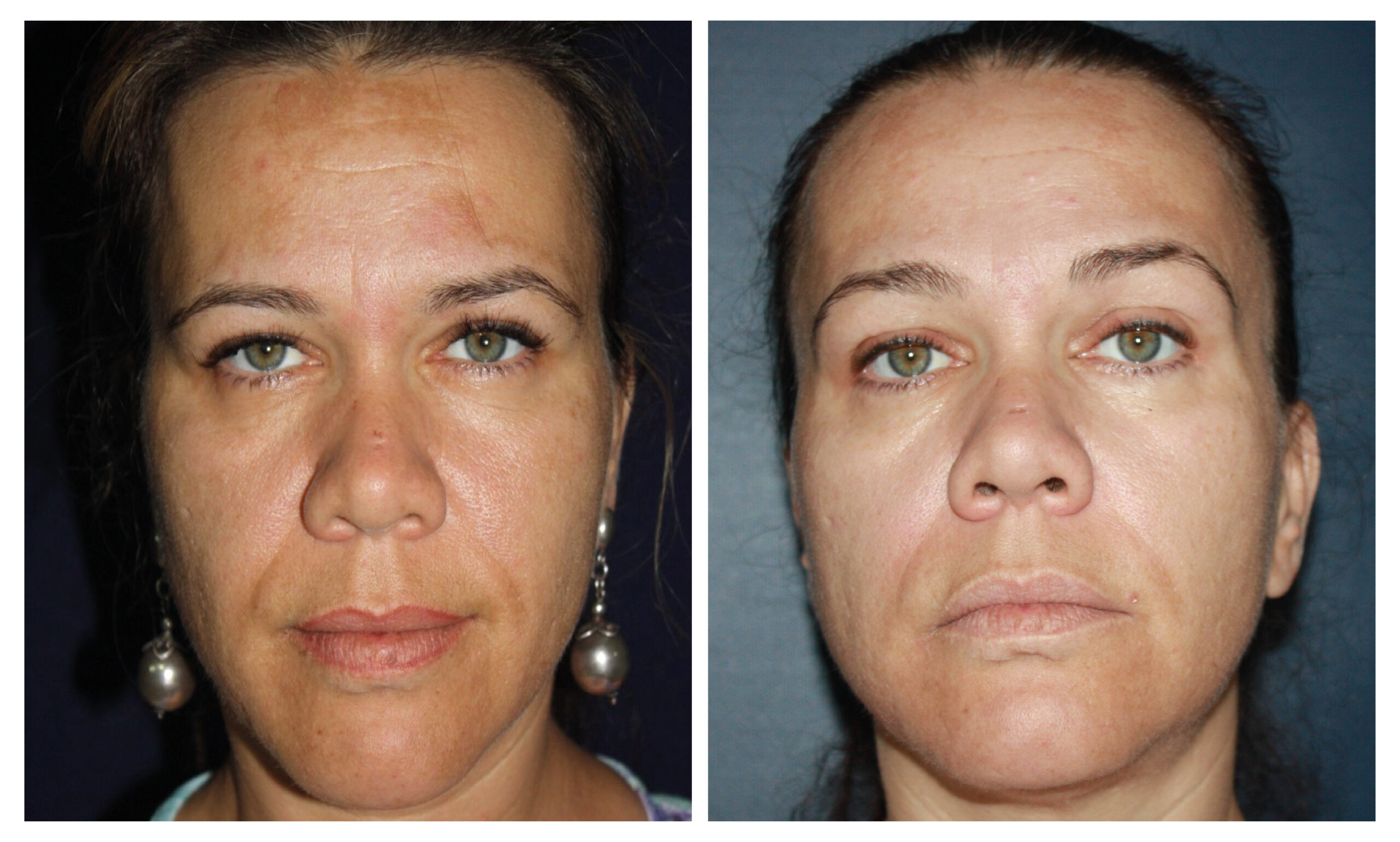 mujer antes y despues