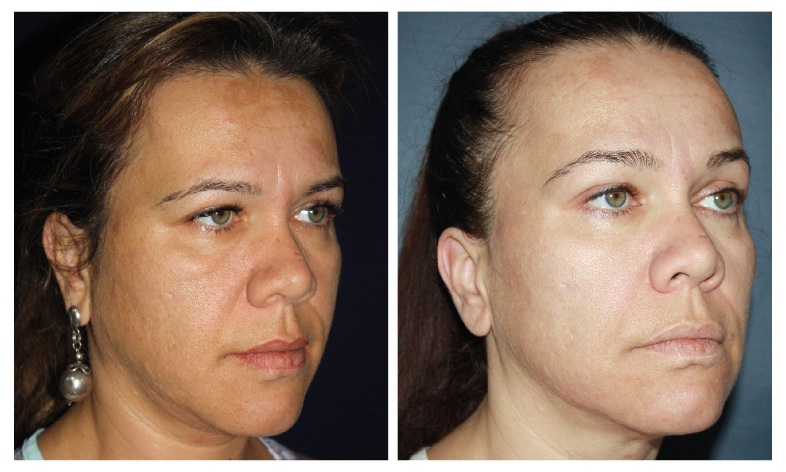 mujer antes y despues