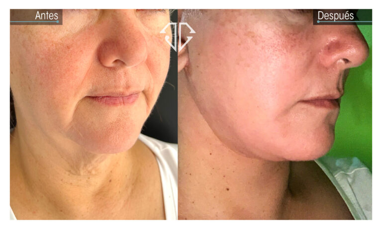 casos paginna web (deep)33_Mesa de trabajo 1 copia 17